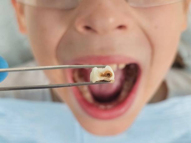 Best Walk-In Emergency Dentist in Middleburg, FL